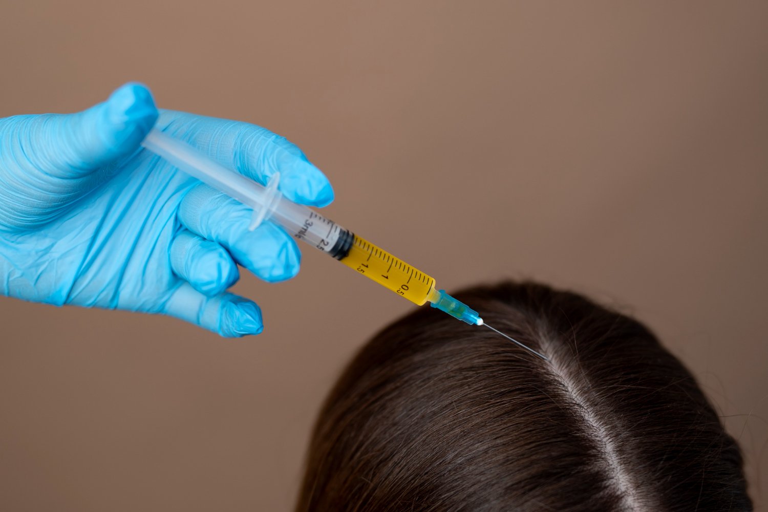 PRP THERAPY