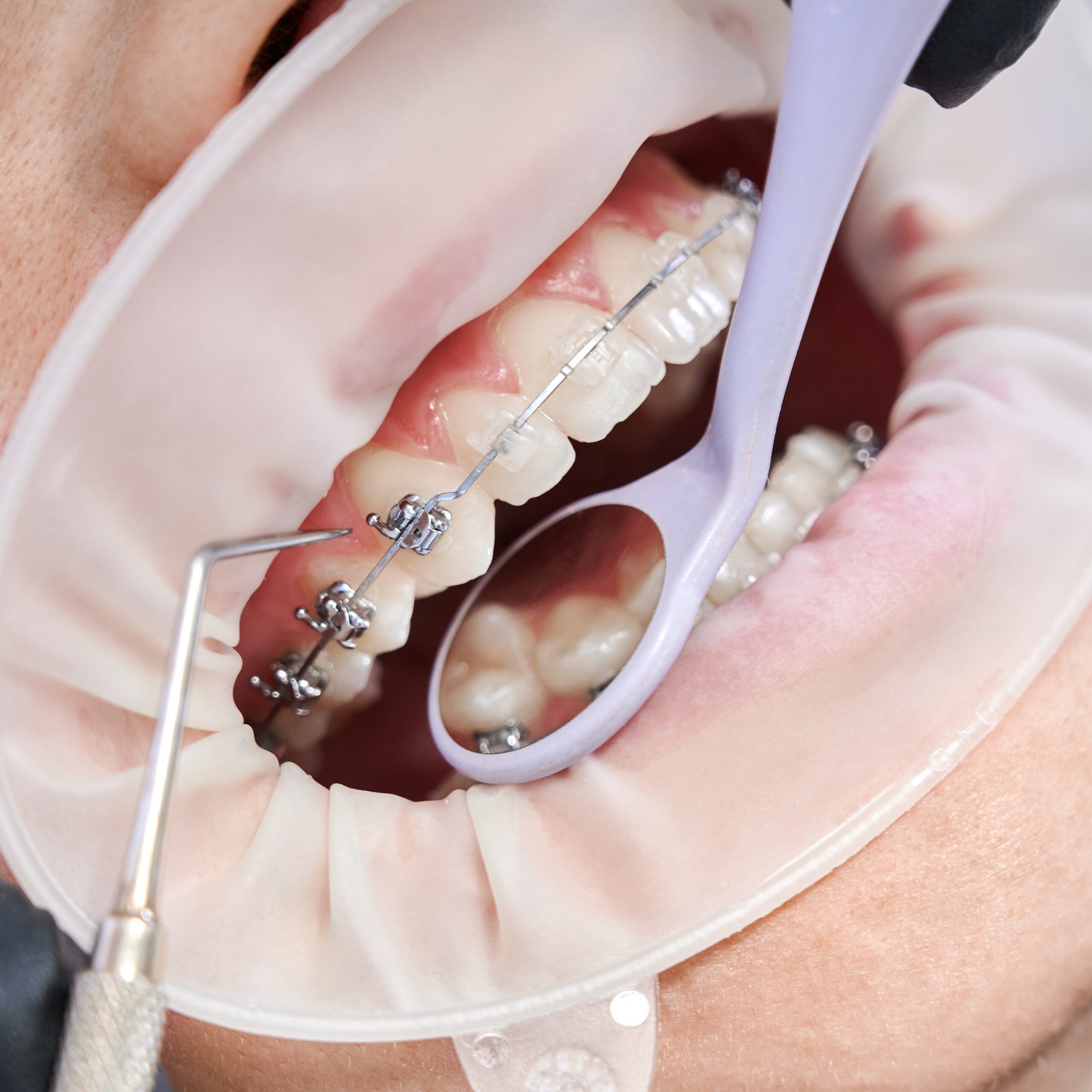 ORTHODONTICS